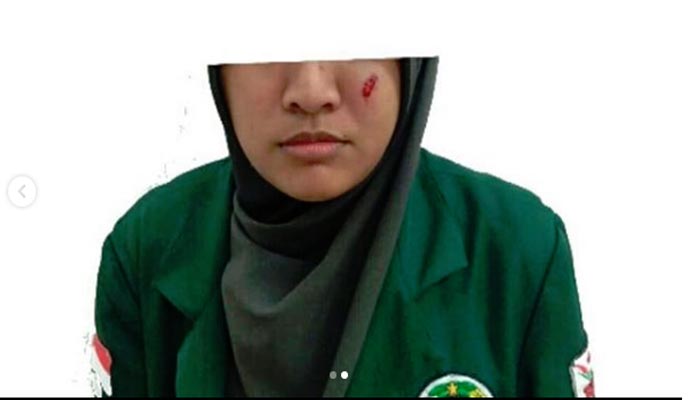 Salah Satu Mahasiswi yang Menjadi Korban Represif Saat Ikut Demo di Medan (Foto Dok. Pema USU)